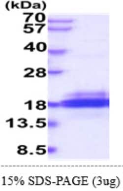 Novus Biologicals&trade;&nbsp;SH2D1B Recombinant Protein